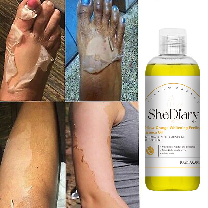 SheDiary 100ml Skin Care Products Whitening Body Lotion Exfoliating Lightening Orange Peeling Lotion