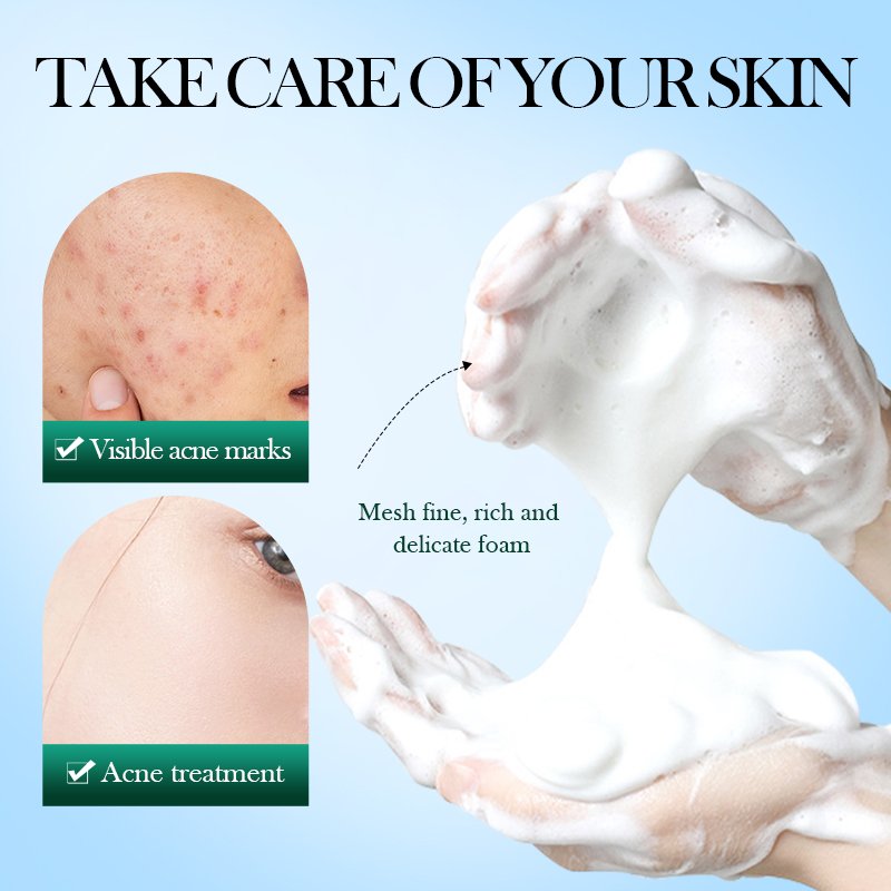 NEW 150g Wholesale Private Label Skin Care Anti Acne Oil Control Gentle Cleansing Tea Tree Bubble Cleanser clean mousse