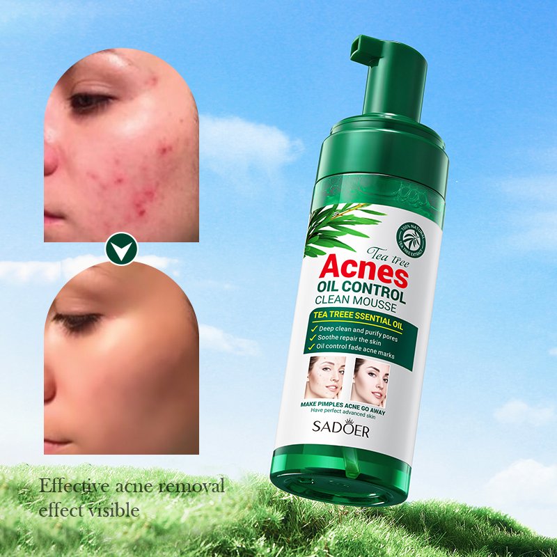 NEW 150g Wholesale Private Label Skin Care Anti Acne Oil Control Gentle Cleansing Tea Tree Bubble Cleanser clean mousse