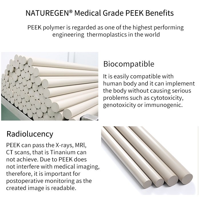 OEM factory high quality medical grade peek raw materials implantable peek plastic rod