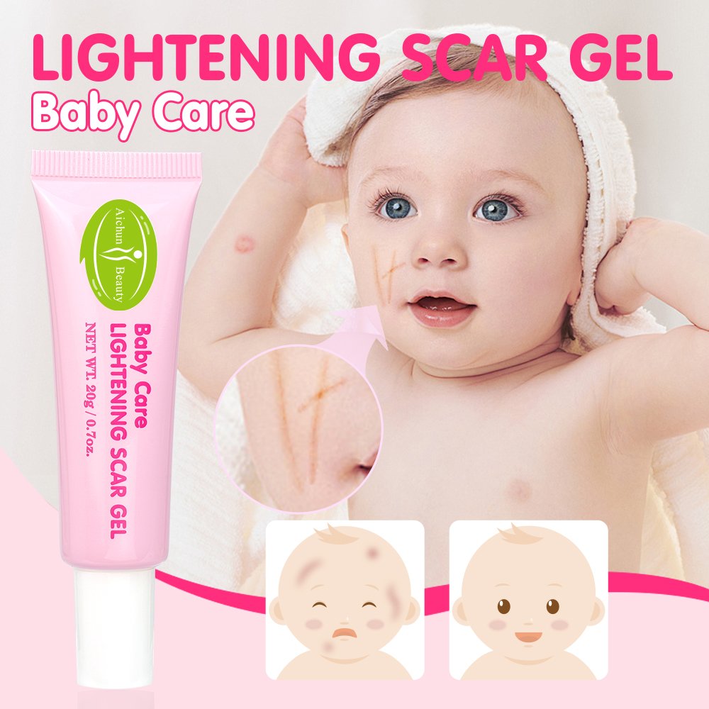 Natural Baby Lightening Scar Gel With Aloe Vera Dark Spot Scar Remover Skin Moisturizing Gel Vitamin C Baby Skin Body Care OEM