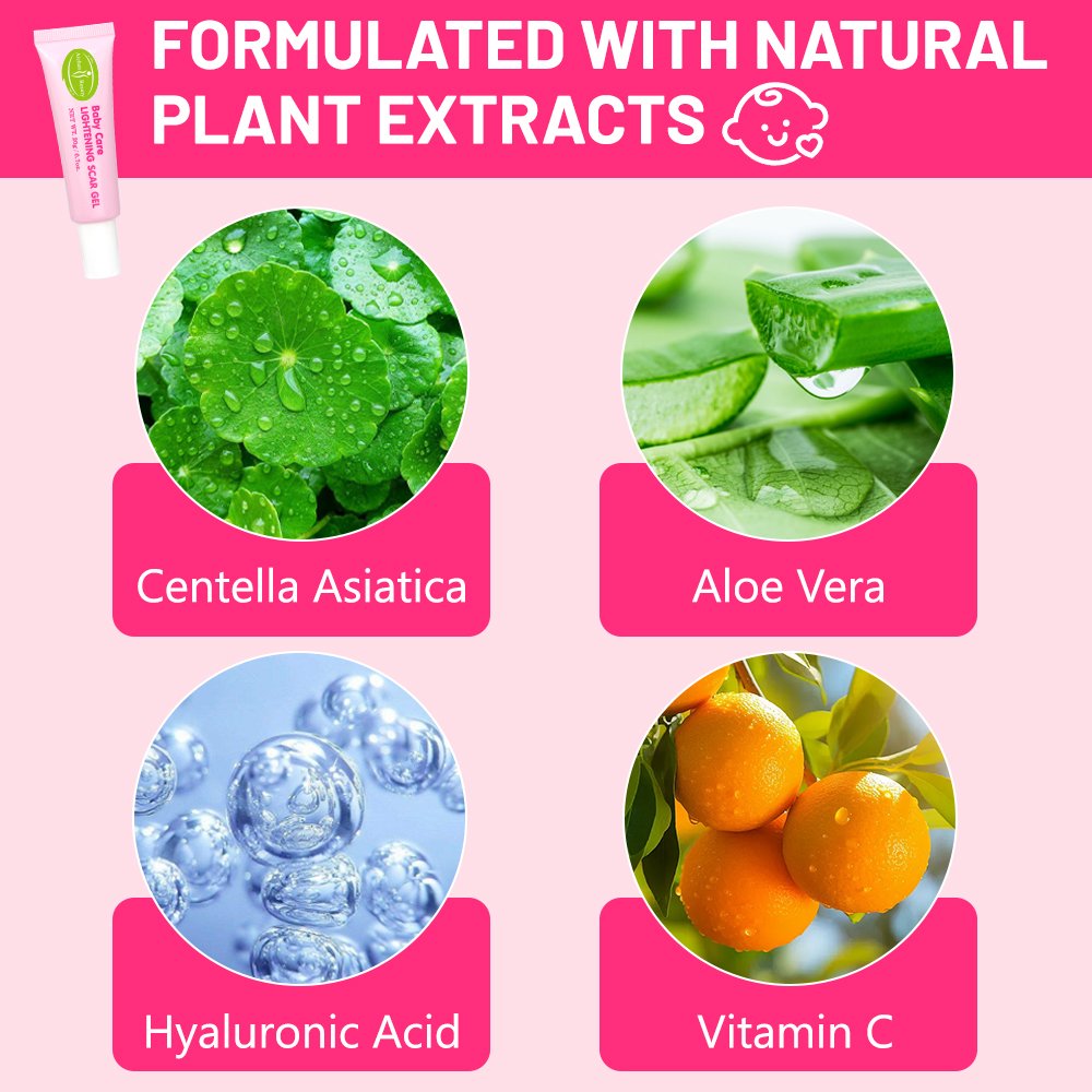 Natural Baby Lightening Scar Gel With Aloe Vera Dark Spot Scar Remover Skin Moisturizing Gel Vitamin C Baby Skin Body Care OEM