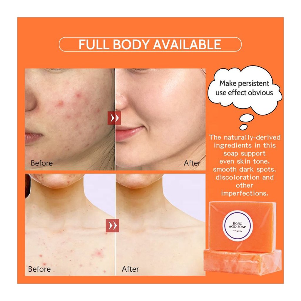 Kojic Acid Soap Skin Brightening Lightening Bath Bleaching Body Face Whitening Kojic Acid Soap