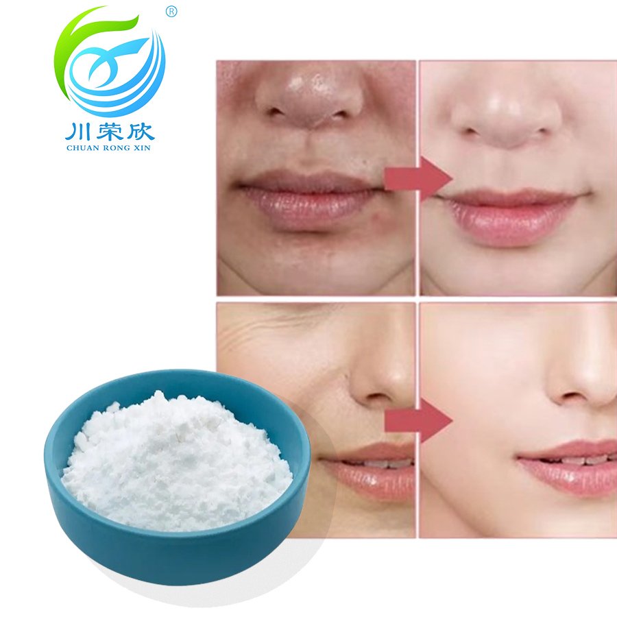 Daily chemicals ordinari niacinamid niacinamide powder CAS 98-92-0 for Skin Whitening