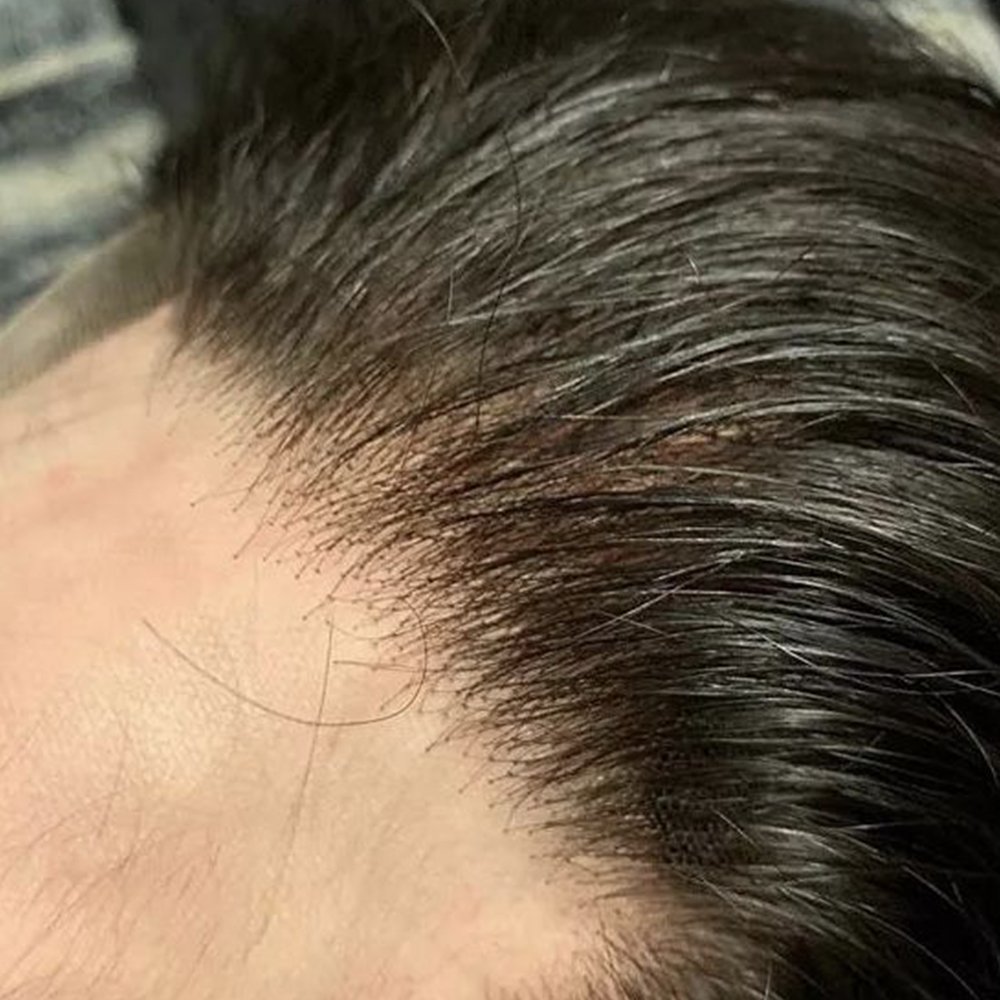versalite -invisible Lace Front hairline product for men 100% Indian Human Hair Toupee Men Wig Systems