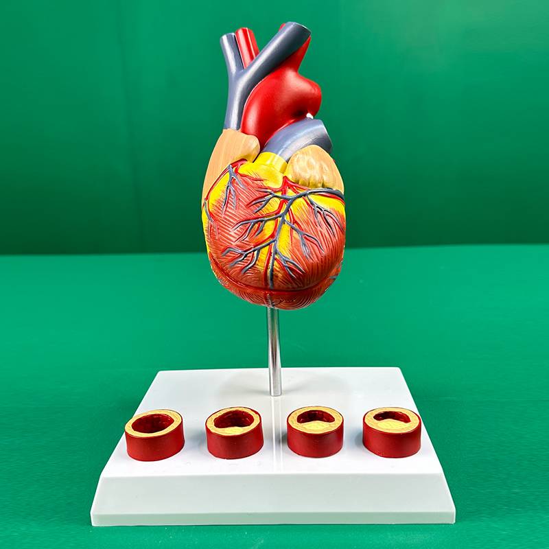 Heart model 4 phase blood vessels