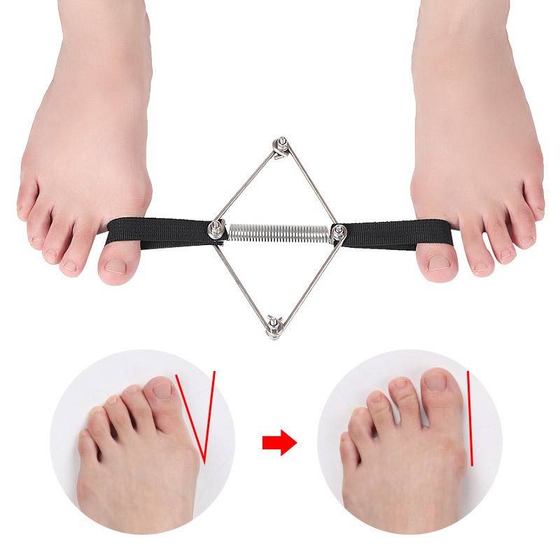 Thumb correction with the thumb feet auxiliary trainer exercise tension with large toes overlap stretch