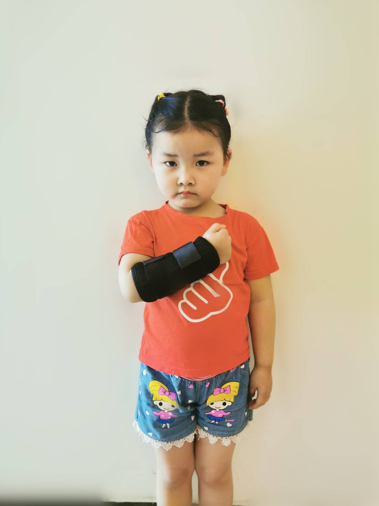 Children's arm bone fracture fixing protective gear radius ulnar splint arm bracket