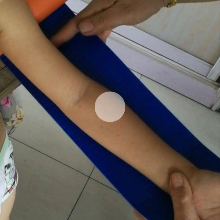Medical fracture splint, arm, legs and feet sprains, troops training dog pet children first -aid fixed protective gear
