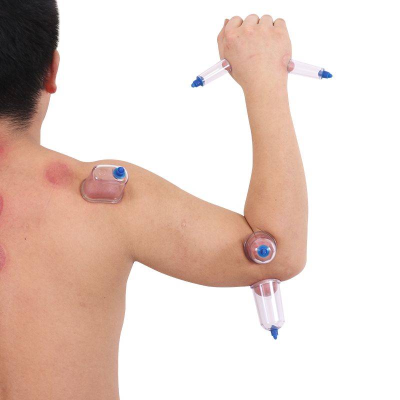 Vacuum cupping device Household set Blood tank thorns Blood brush heart stasis stasis special cupping special blood leakage set